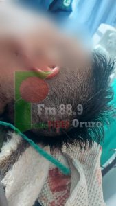 Policías heridos en Pazña