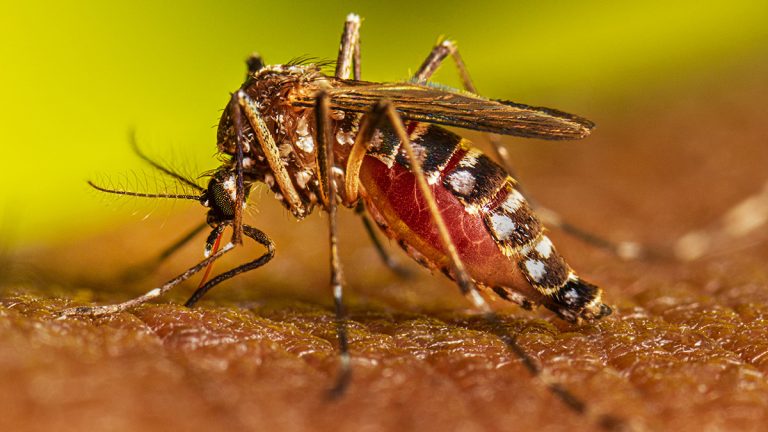 Dengue /Imagen de referencia/