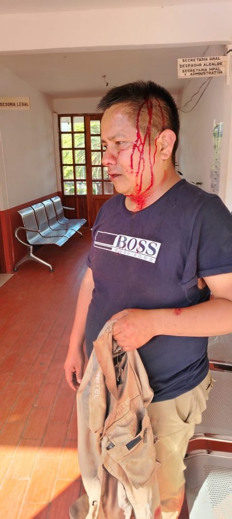 Joshue Chuve, periodista vallegrandino, atacado en Mairana